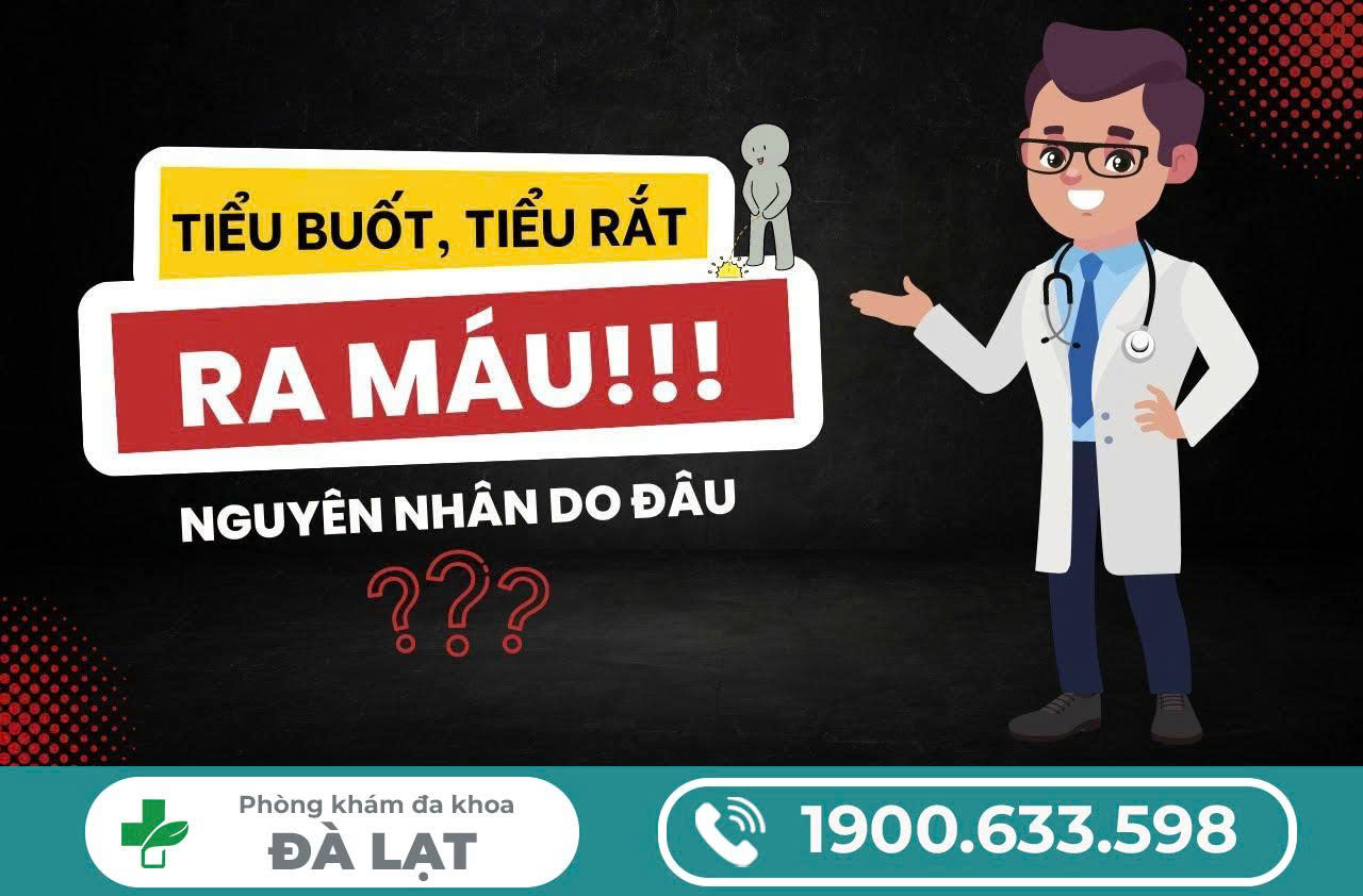 Hình ảnh minh họa